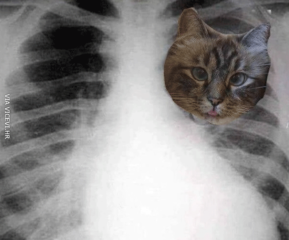 Kad doktor snimi rendgensku sliku mojih pluća