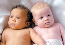 Rođeni blizanci Richardson, od kojih je jedan bijel, a drugi crn
